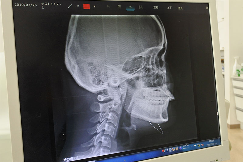 矯正歯科専用の骨格レントゲン
